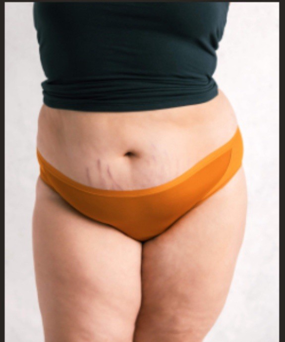Saalt Leakproof Mesh Bikini